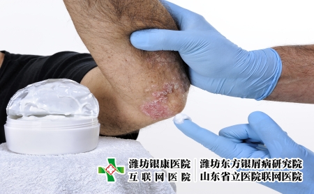 攝圖網_503148875_用手套保護雙手的皮膚科醫(yī)生用乳膏治療患有銀屑病的成年男（企業(yè)商用）
