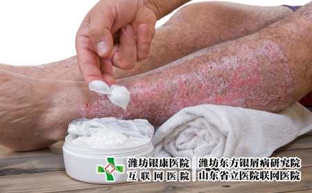 攝圖網(wǎng)_502709980_皮絲蟲(chóng)病是皮膚慢發(fā)炎疾病（企業(yè)商用）