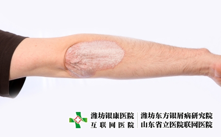 攝圖網(wǎng)_327921215_微絲蟲(chóng)病藥物皮膚濕疹疾病人體皮疹皮炎痛苦燒傷醫(yī)生（企業(yè)商用）