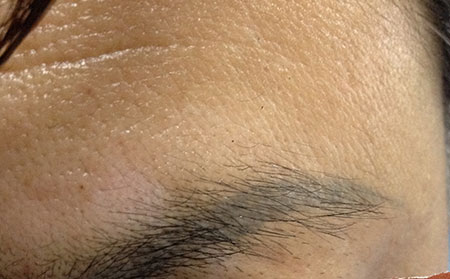 治療白癜風,治療白癜風偏方,治療白癜風醫院